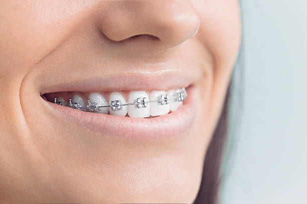 Best Invisalign and Clear Aligners  in Dash Point, WA